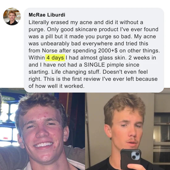 Before and after result 1