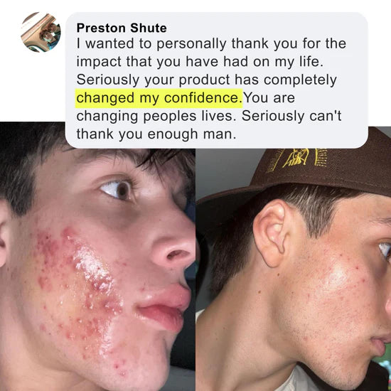 Before and after result 2