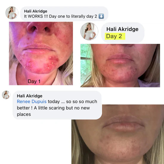 Before and after result 3