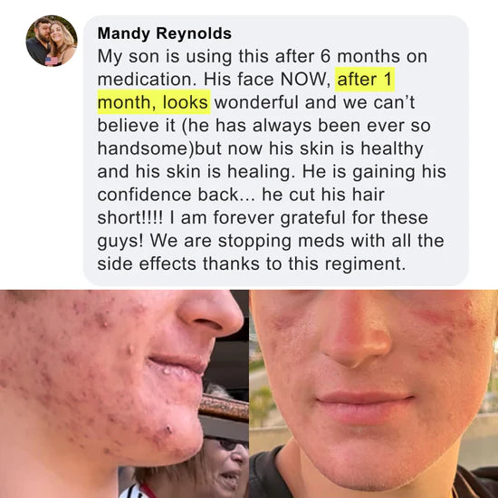 Before and after result 5