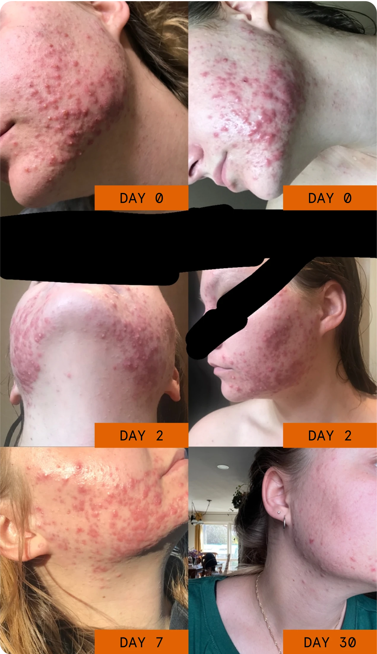 Julia's before and after progress